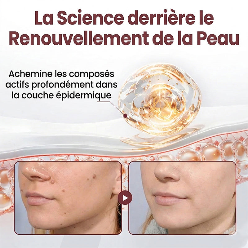 AuraGen® Stylo à double embout pour l'élimination des verrues