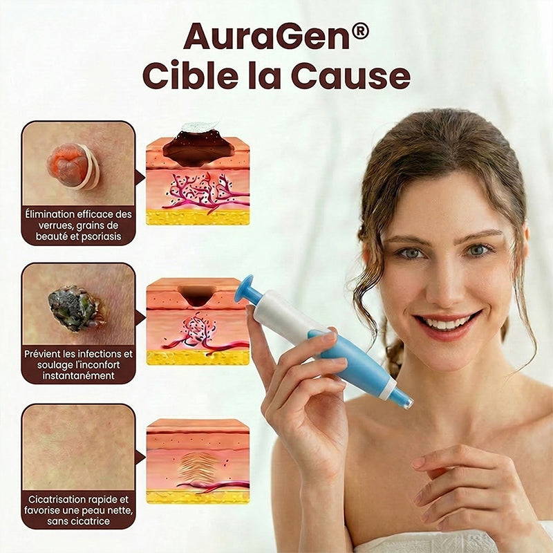 AuraGen® Stylo à double embout pour l'élimination des verrues